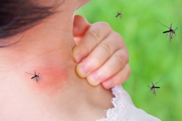 Komáre, ovady, včely, osy a ďalší hmyz: Prvá pomoc pri ich uhryznutí, bodnutí, pichnutí a uštipnutí