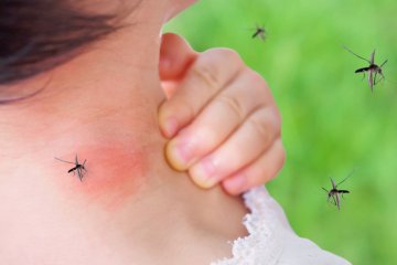 Komáři, ovádi, včely, vosy a další hmyz: První pomoc při jejich kousnutí, bodnutí, píchnutí a štípnutí