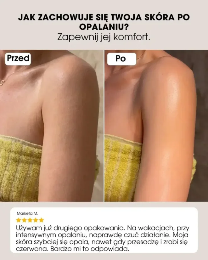 PL Mleczko regenerujące po opalaniu z koenzymem Q10 150 ml - opinie klientów, porównanie przed i po użyciu produktu