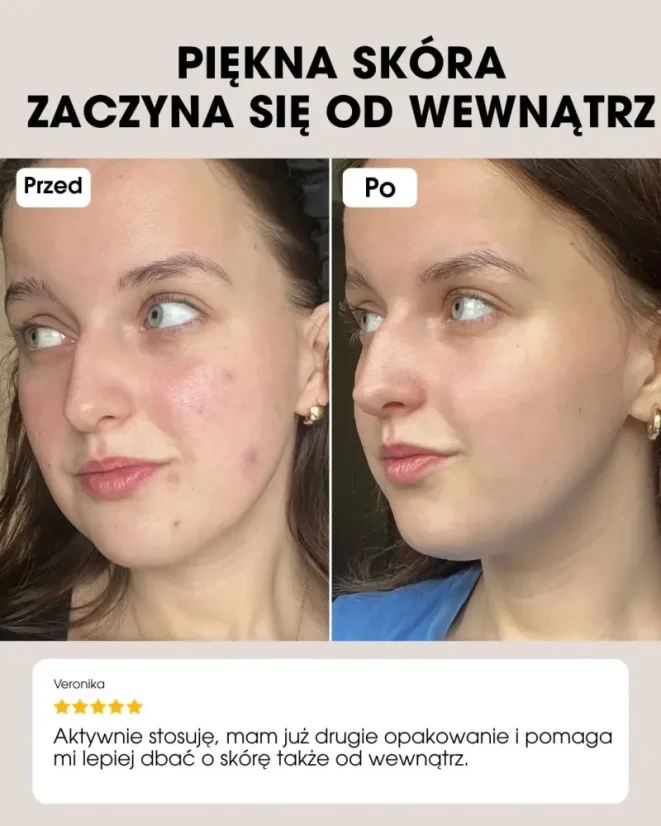 PL Beauty Vitamins - Clear Skin opinie klientek