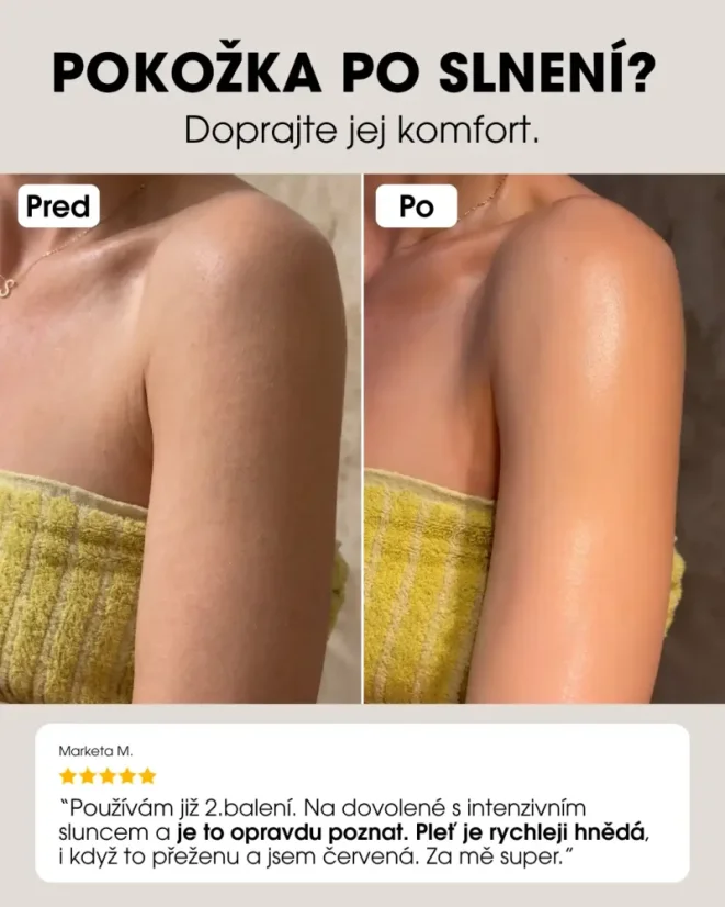 SK Regeneračné mlieko po opaľovaní pred a po použití