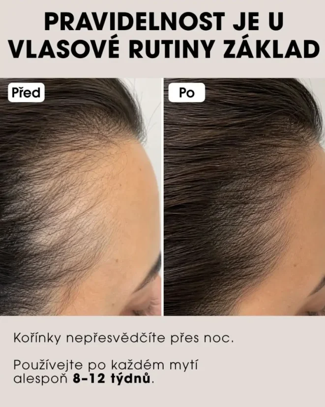 Sérum na podporu růstu vlasů s chininem - Hair Growth Booster 30 ml