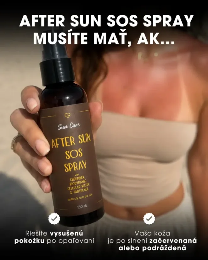 SOS sprej po opaľovaní s panthenolom 5 % a aloe vera 150 ml