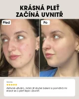 Beauty Vitamins - Clear Skin (ac-ne) - pre problematickú pleť s probiotikami Bifiacnel® - 120 kapsúl