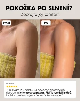 SK Regeneračné mlieko po opaľovaní pred a po použití