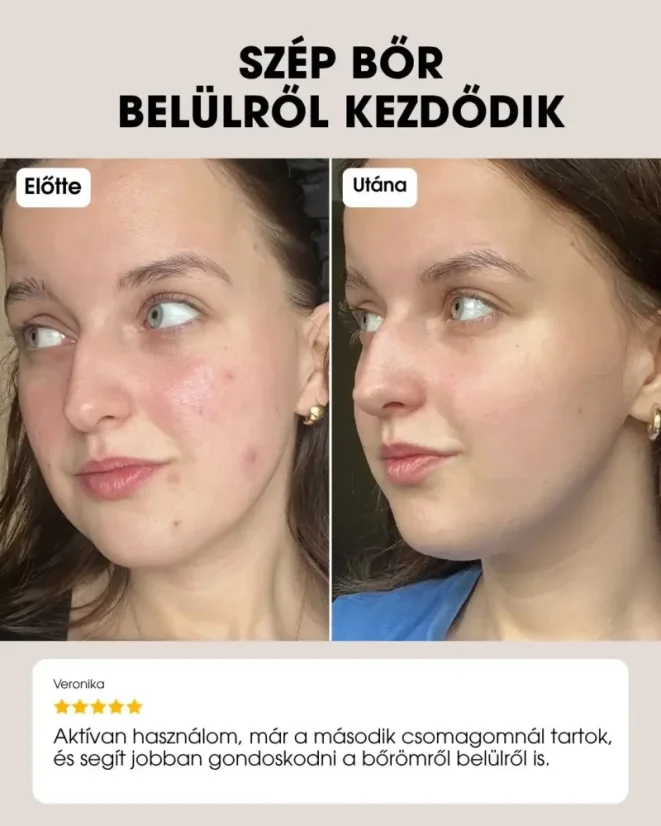 HU Beauty Vitamins - Clear Skin vásárlói vélemények